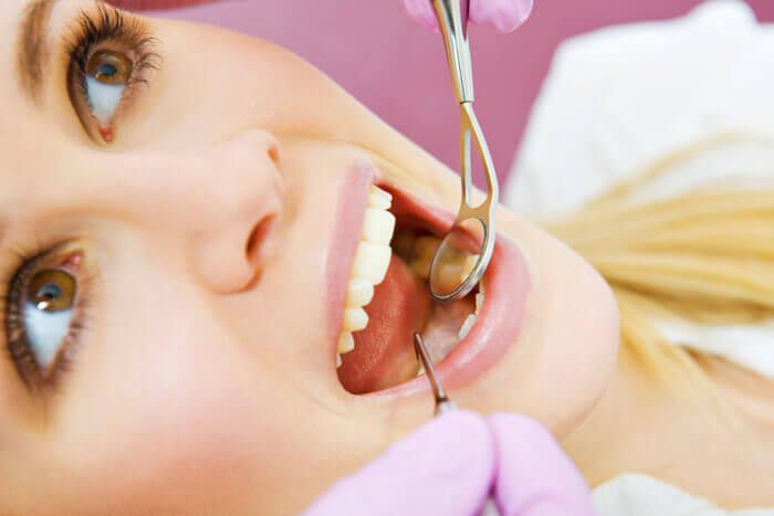 A woman receiving a root canal